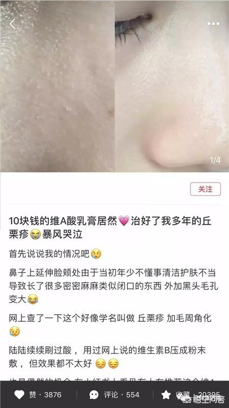 小红书种草式营销模式
:小红书的种草到底有多少套路？